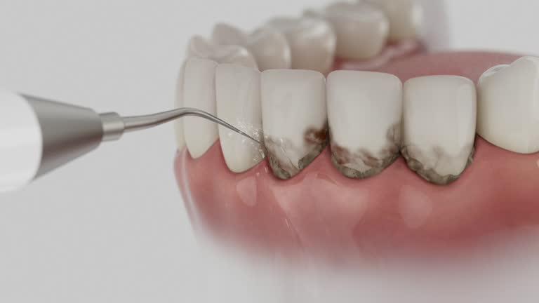 Reliable Dental contractor in Dundas, MN by Smile Center Dentistry